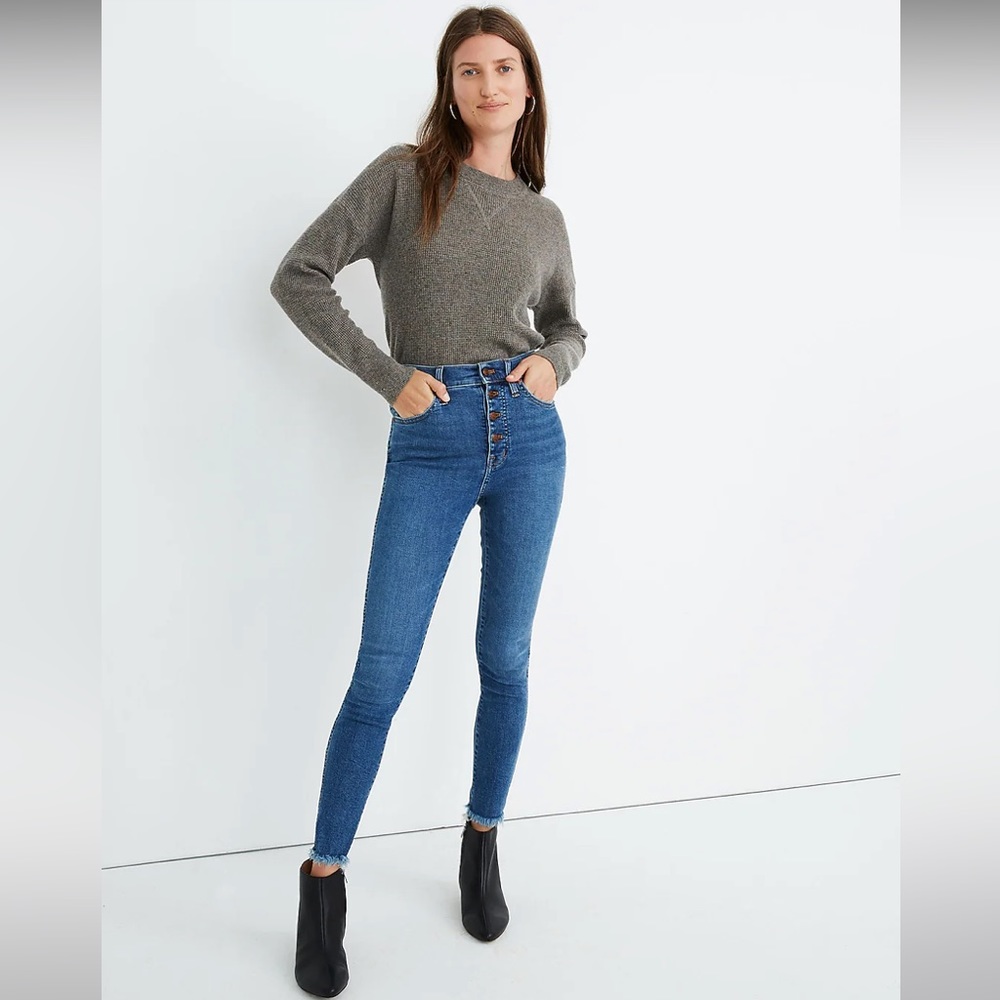 Madewell Button Front 10" High Rise Skinny Jeans
